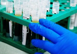 Aktualita OKBD – změna jednotek FOB