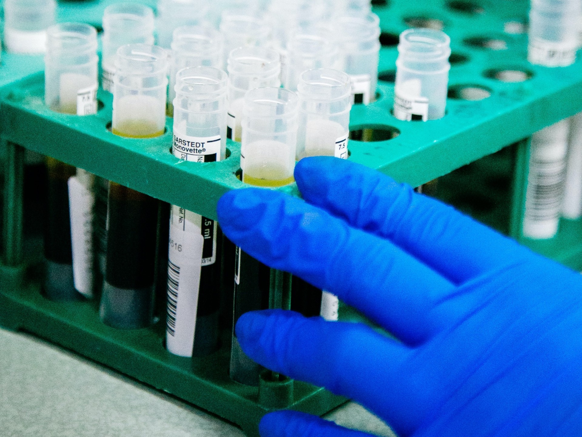 Aktualita OKBD – informace pro lékaře